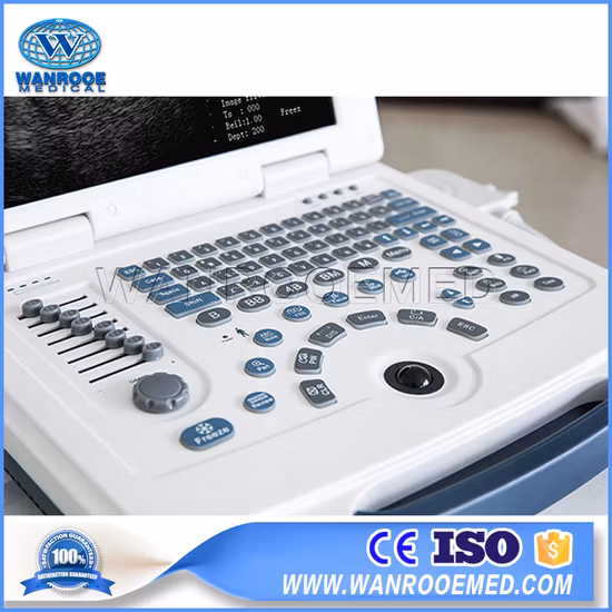 Цифровое портативное ультразвуковое диагностическое оборудование Ультразвуковой сканер